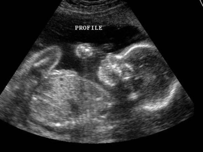 2013-07-19-ultrasound_640x480