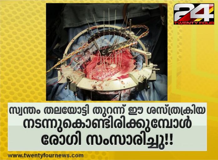 Brain Surgery