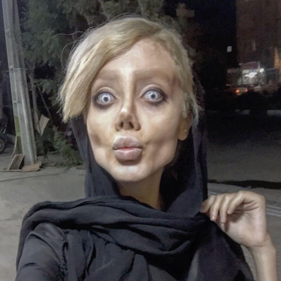  Teen’s plastic surgery to look like Angelina Jolie goes very wrong